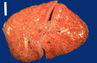 yx02cytomegalorvirus adrenal.JPG (8479 bytes)